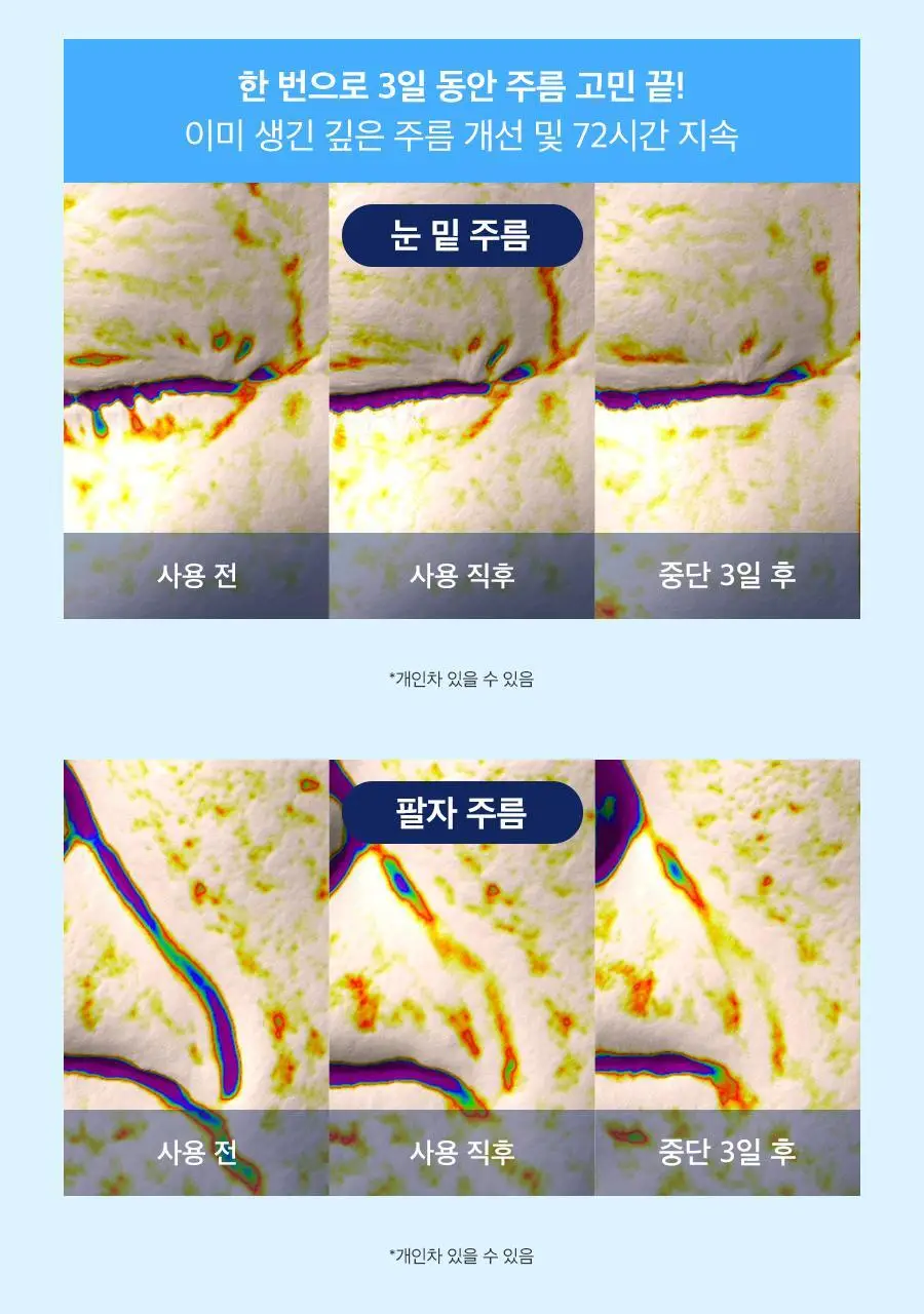 [4+1/속광탄력] 닥터지 블랙스네일 레티놀 링클 마스크 4+1 증정 기획 상세페이지 25
